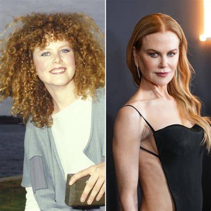 The Truth About Nicole Kidman's Plastic Surgery: Before And After